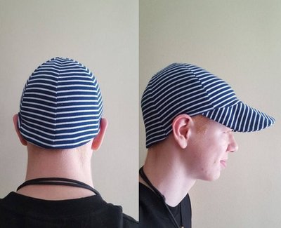 Sasha Chemo or Hair Loss Cap Pattern